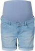 Supermom Jeans shorts Light Blue Light Blue Denim 26 online kopen